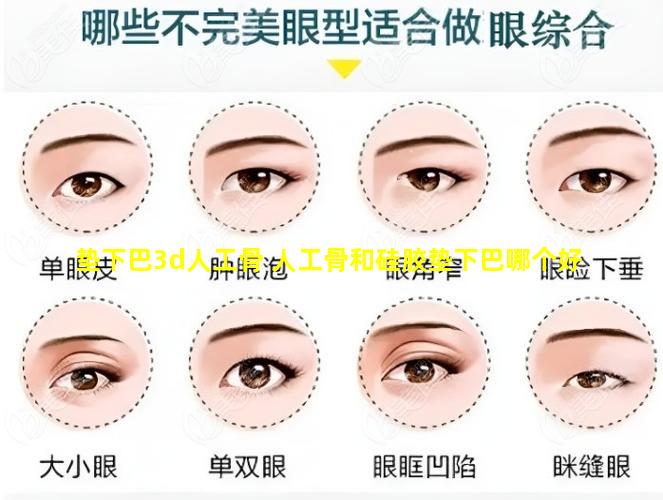 垫下巴3d人工骨 人工骨和硅胶垫下巴哪个好